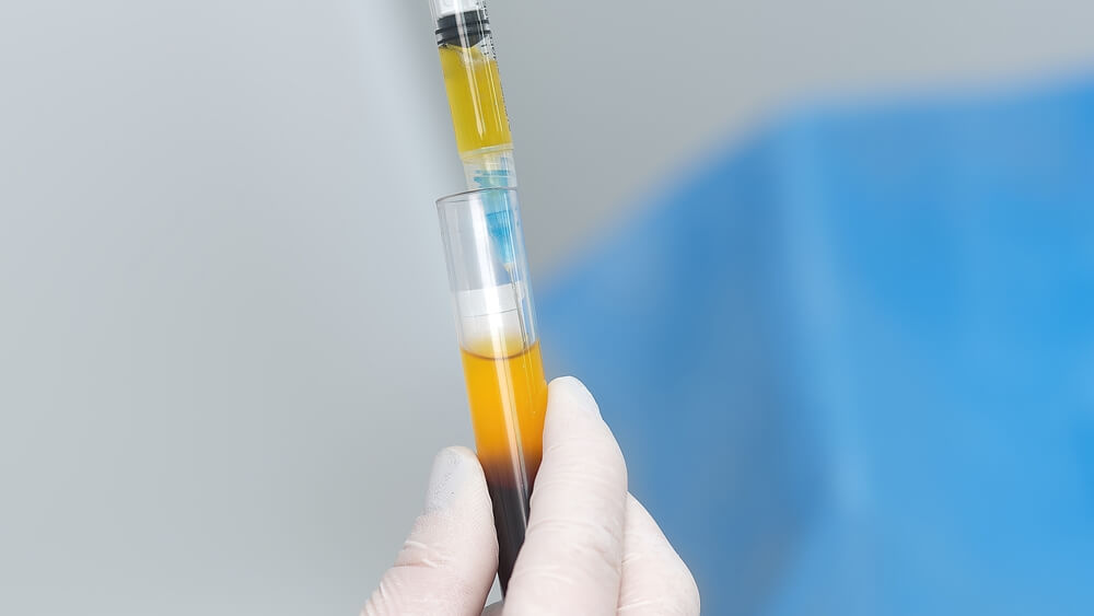 PRP for female arousal