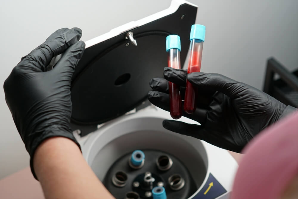PRP for female arousal